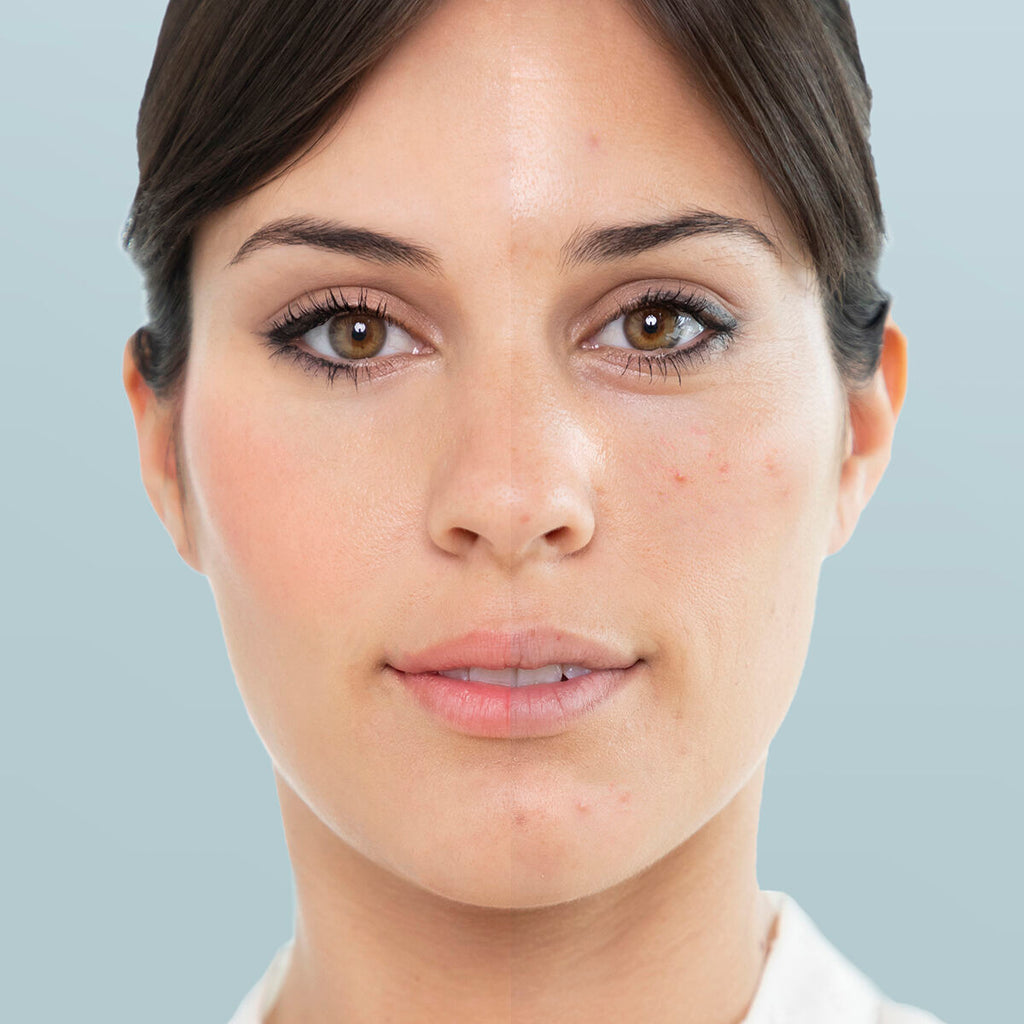 Sauna Facial Vaporizadora Moispa - Spa en Casa